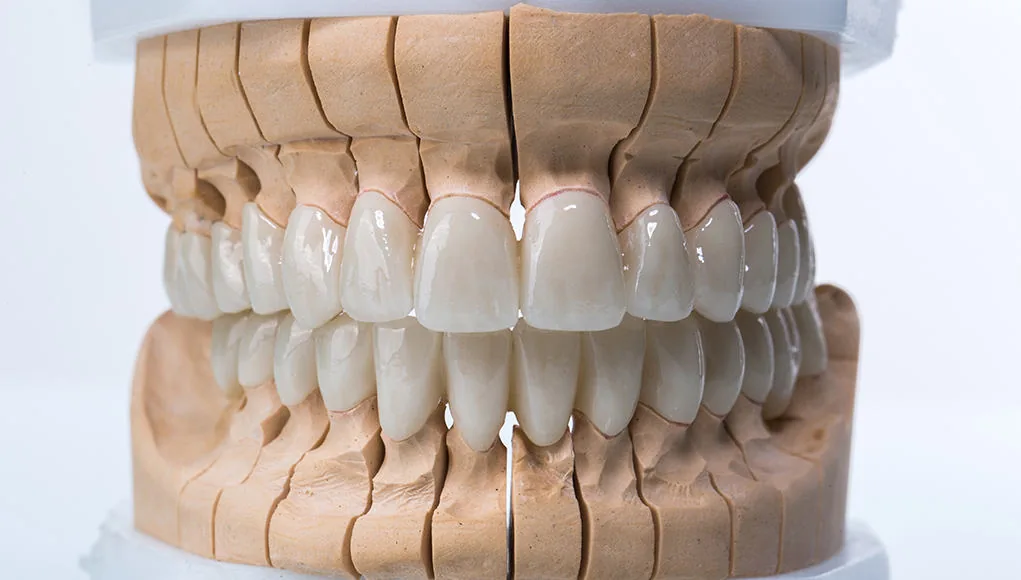 Platin Dental model ve protez detay çalışması